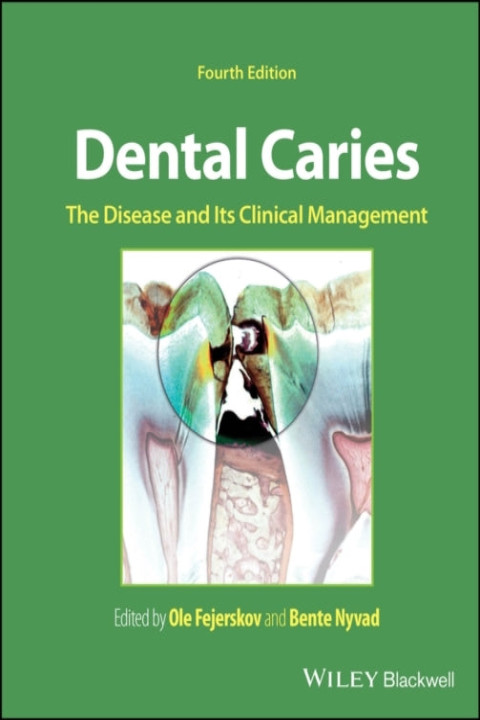 Omslag: Dental Caries