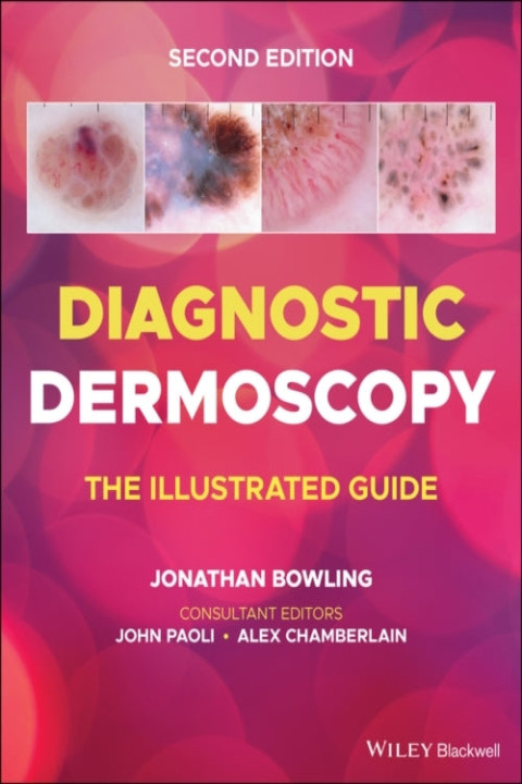 Omslag: Diagnostic Dermoscopy